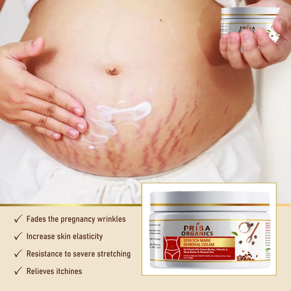 Stretch Mark Removal Cream to Reduce Stretch Marks, Scars, Spots, Discolouration, 100gm